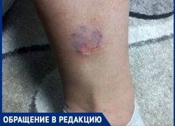 В январе собаки покусали 90 шахтинцев, и это только приехавшие в травмпункт В январе собаки покусали 90 шахтинцев, и это только приехавшие в травмпункт